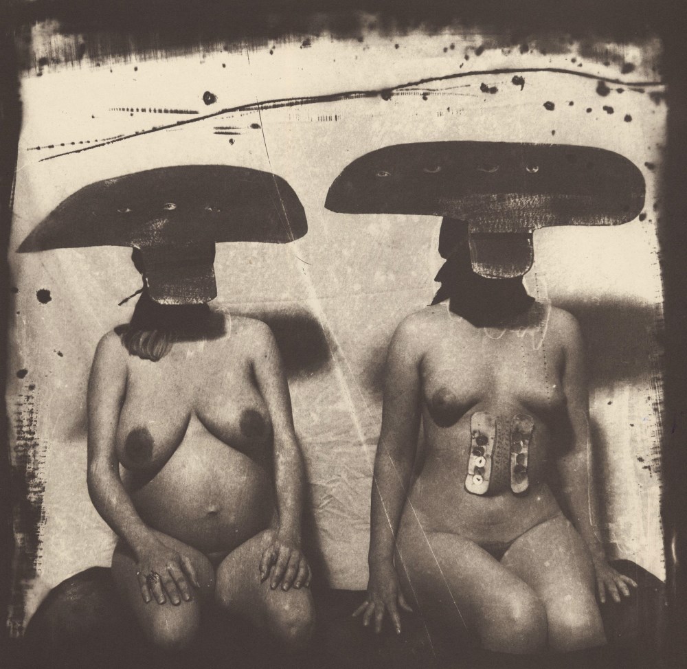 JOEL-PETER WITKIN - I.D. Photograph from Purgatory: Two Women with Stomach Irritations - Original...