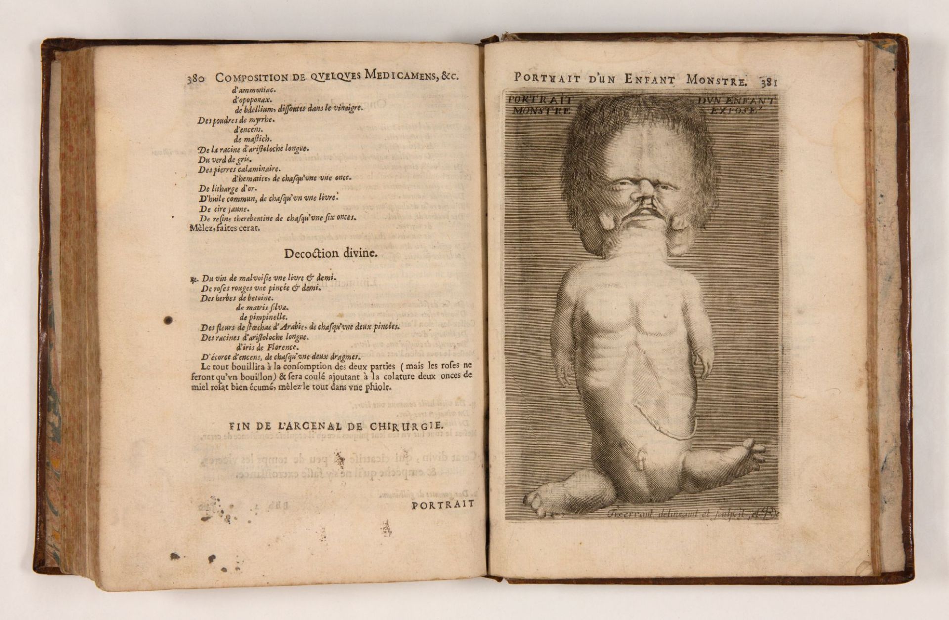 J. Scultetus, L'arcenal de chirurgie. 2. franz. Aufl. Lyon 1674.
