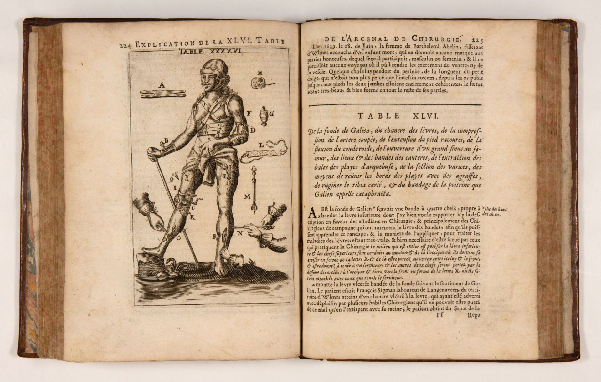 J. Scultetus, L'arcenal de chirurgie. 2. franz. Aufl. Lyon 1674. - Bild 3 aus 3