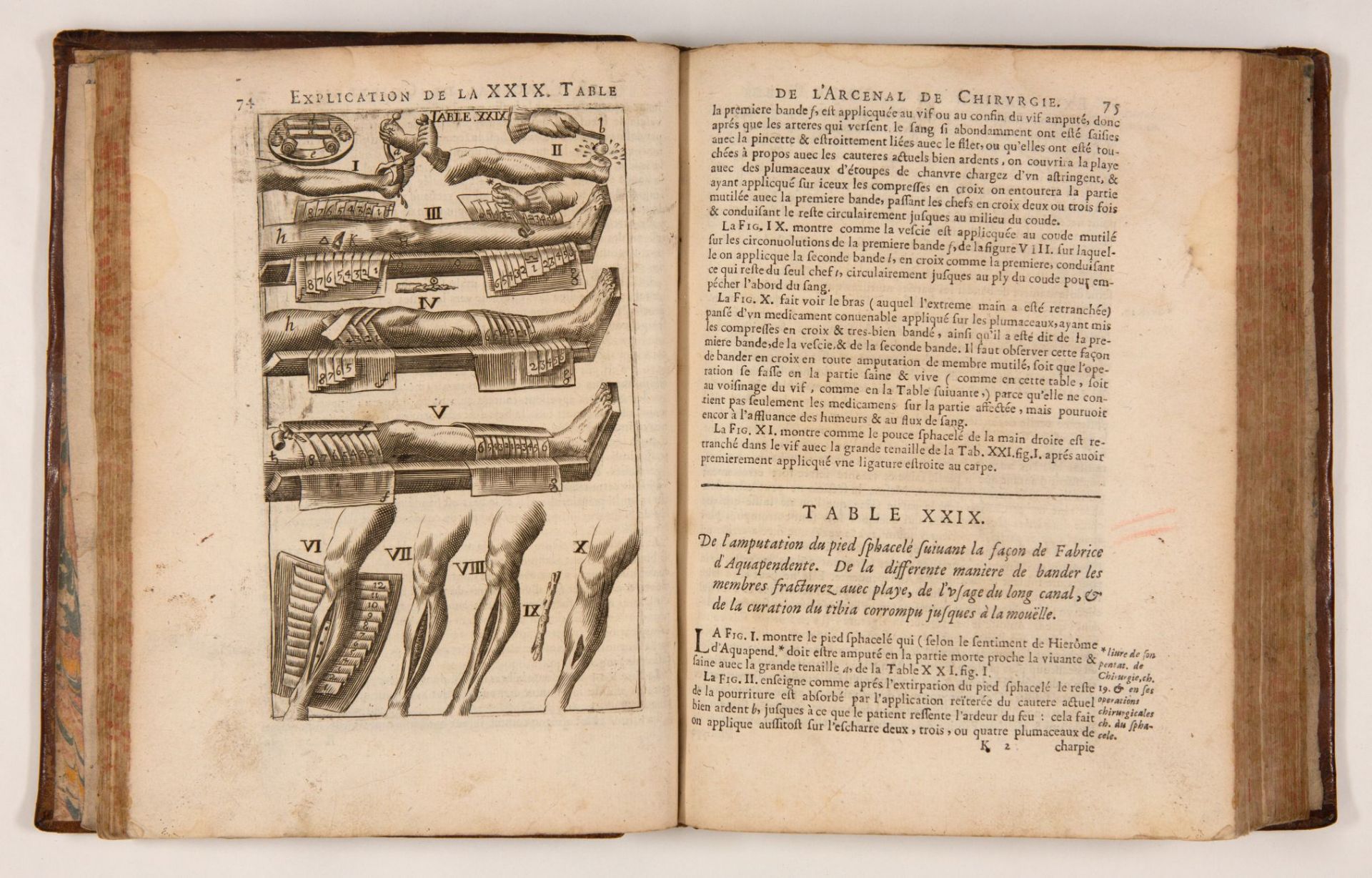 J. Scultetus, L'arcenal de chirurgie. 2. franz. Aufl. Lyon 1674. - Bild 2 aus 3