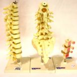 Three anatomical vertebral spine models. P&P Group 3 (£25+VAT for the first lot and £5+VAT for