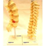 Two anatomical models of vertebrae one with prolapsed disc. P&P Group 3 (£25+VAT for the first lot