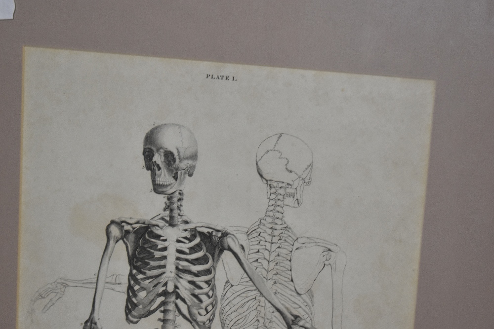 ANATOMICAL PRINTS; a system of anatomical plates by John Lizars comprising general view of the - Image 4 of 5