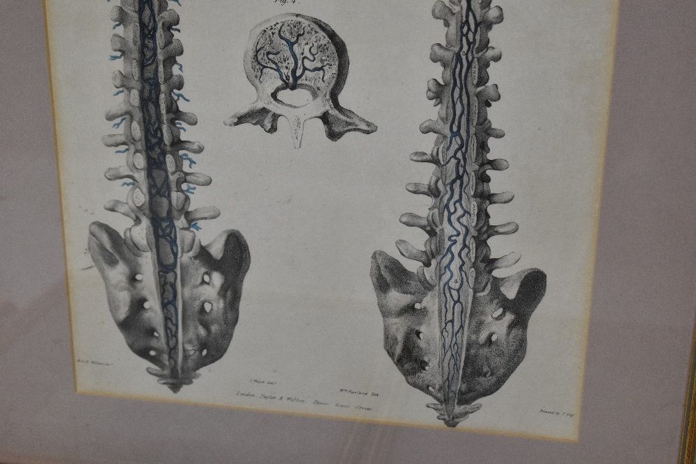 ANATOMICAL PRINTS; a system of anatomical plates by John Lizars comprising general view of the - Image 3 of 5