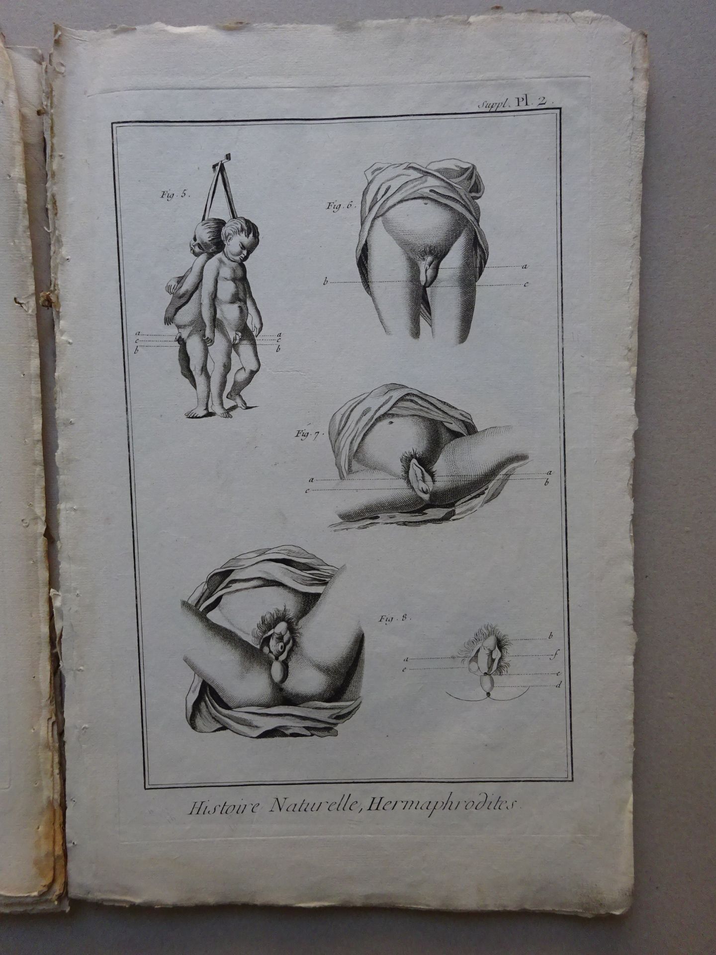 Diderot/d'Alembert - Anatomie + Beig. - Bild 4 aus 9