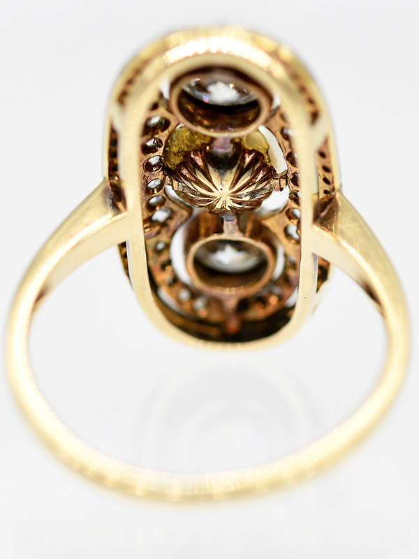 Art Deco-Ring mit Akoya-Perle und Altschliff-Diamanten, zus. ca. 1 ct, 1925-1935. - Image 3 of 3