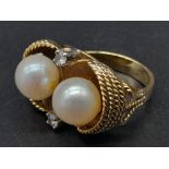 An 18K Yellow Gold Pearl and Diamond Ring. Two round brilliant cut natural diamonds and two near-