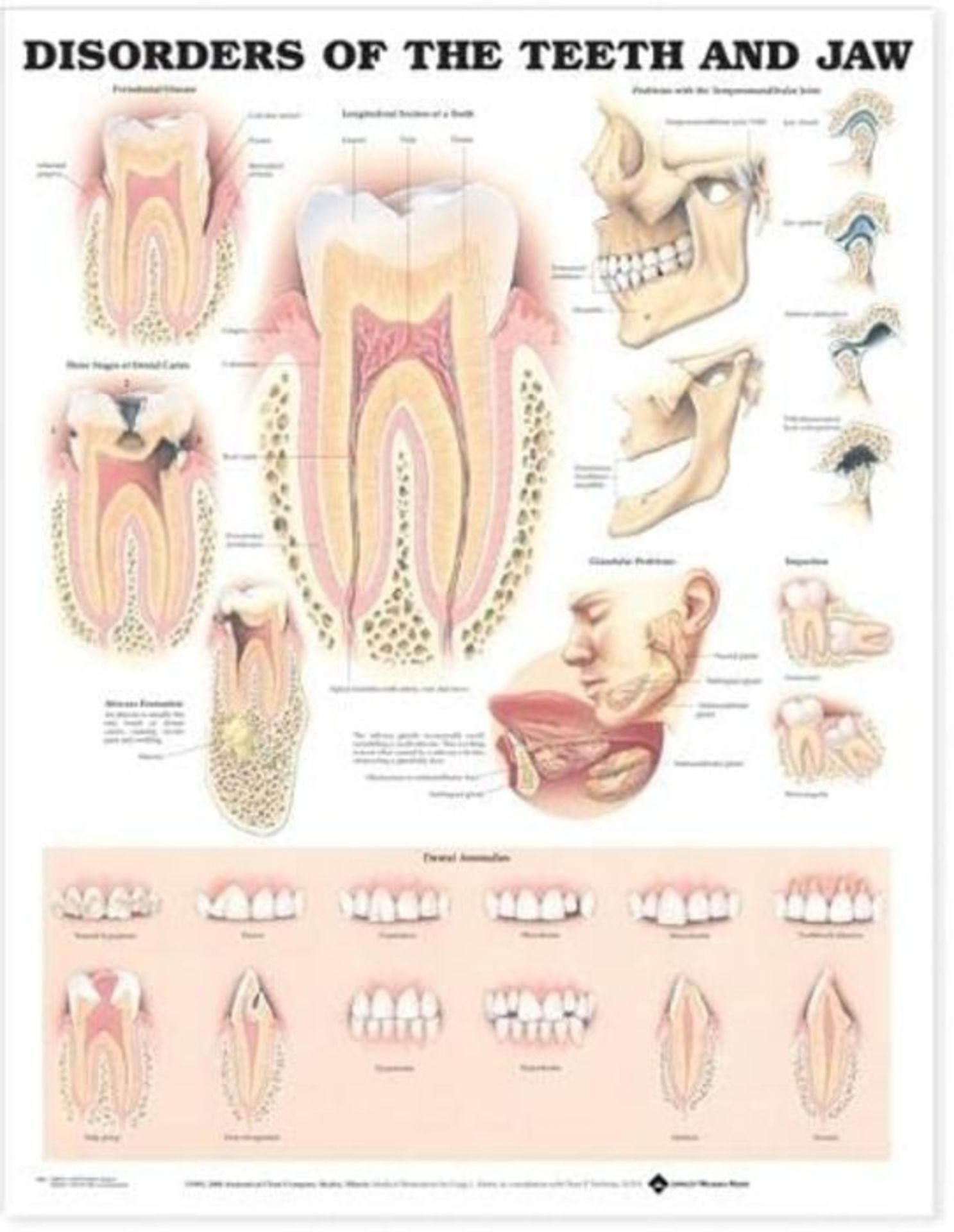 Disorders of the Teeth and Jaw