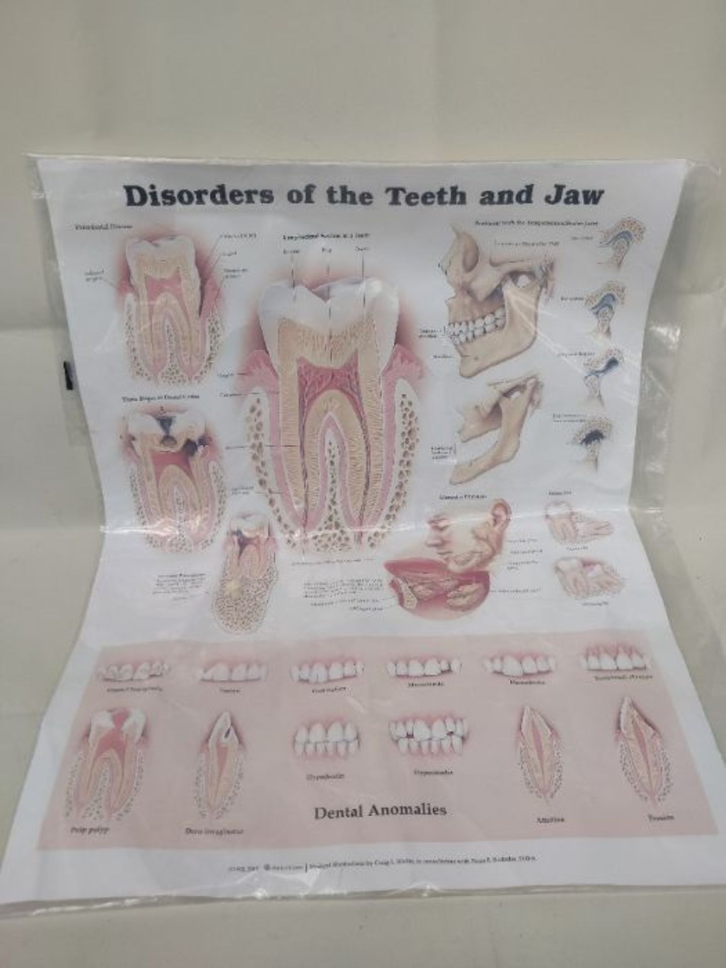 Disorders of the Teeth and Jaw - Image 2 of 2