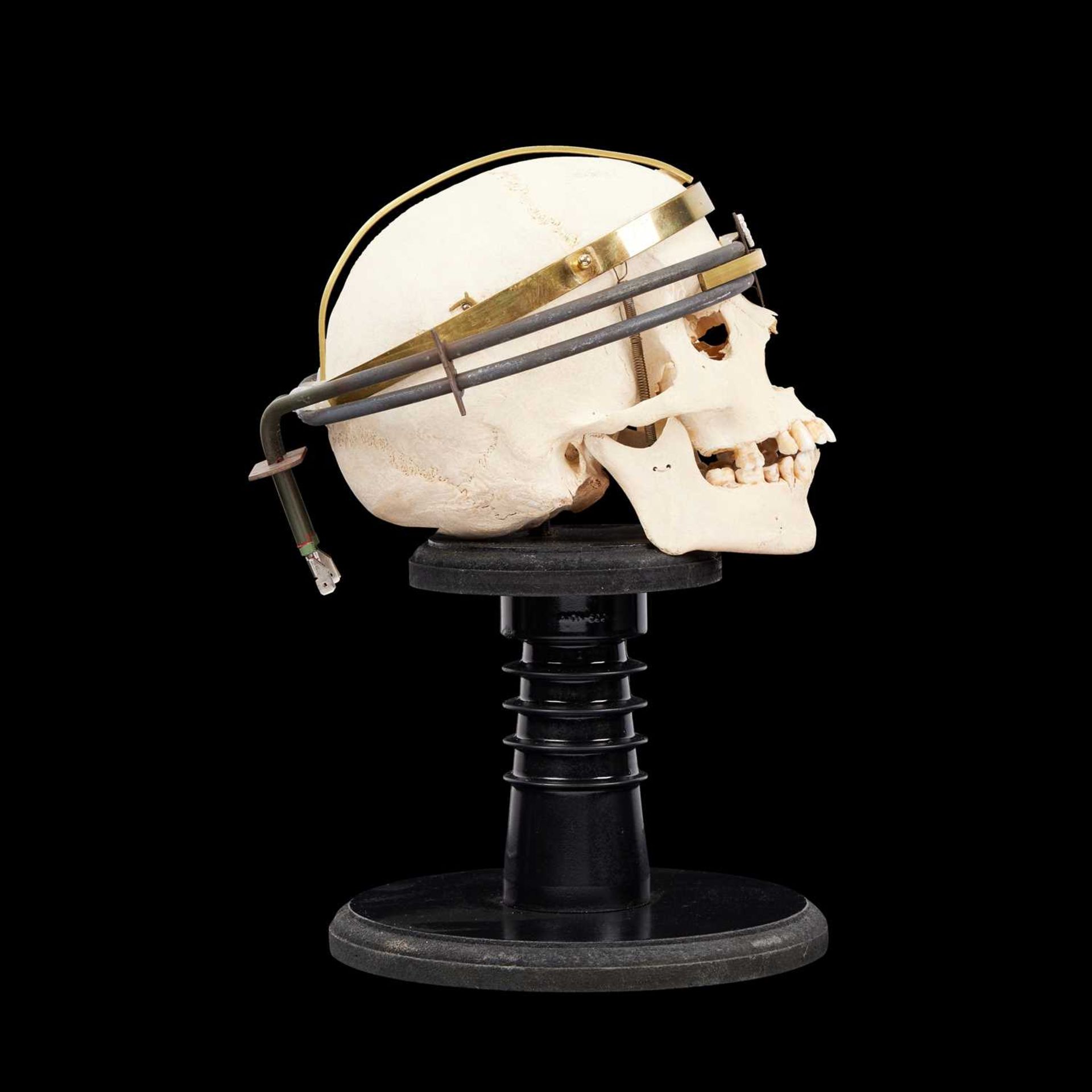 A REAL MEDICAL HUMAN SKULL: 'INTERGALLATIC HEAD HUNTER'S TROPHY' - Image 2 of 3