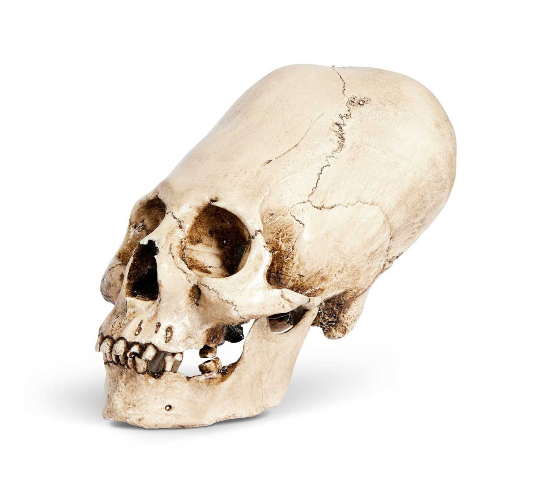 A RESIN MODEL OF AN ELONGATED HUMAN SKULL