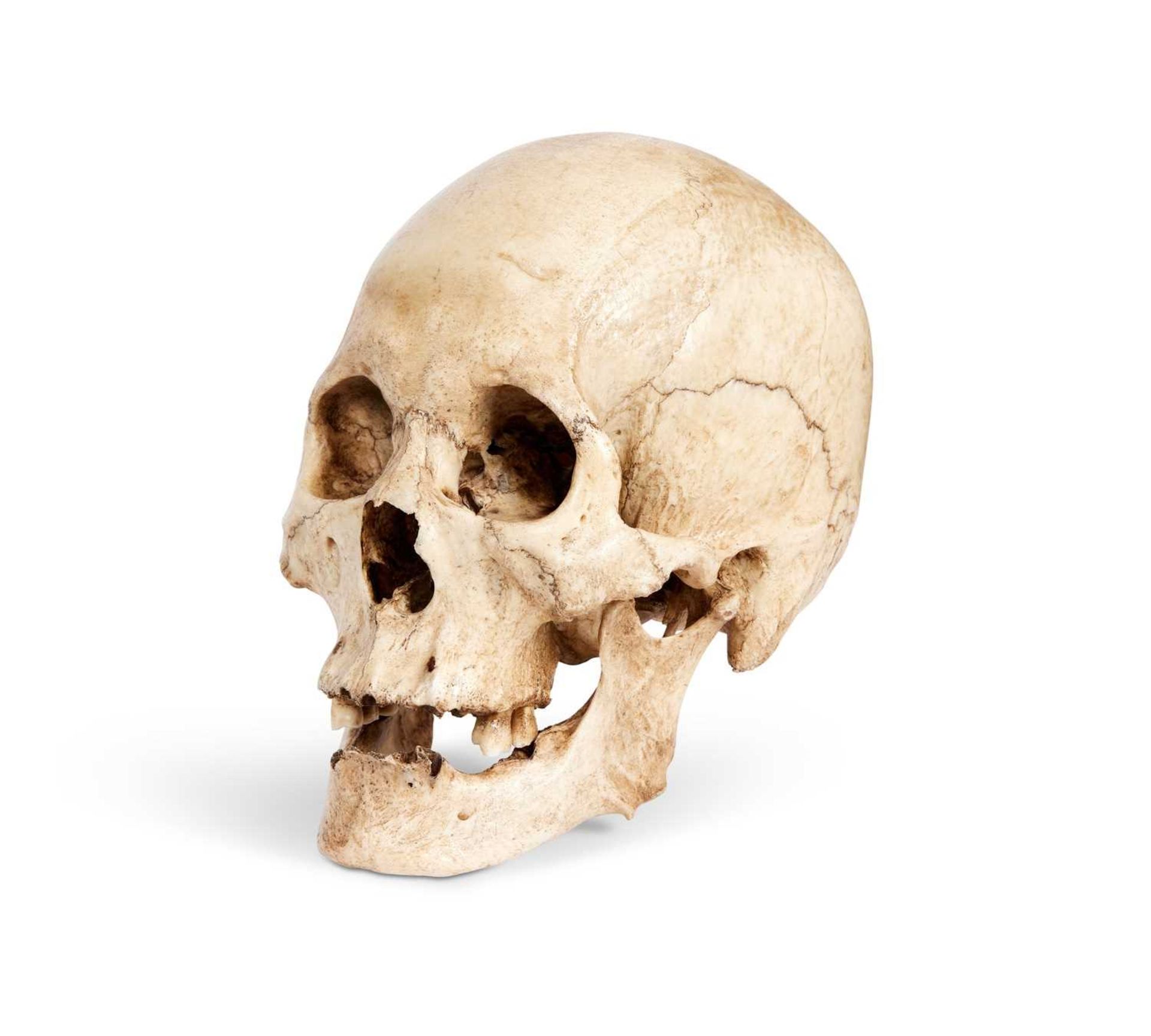 AN OLD GENUINE HUMAN SKULL - Image 2 of 2