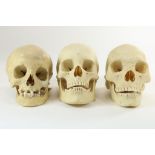 Lot van 3 anotomische schedels
