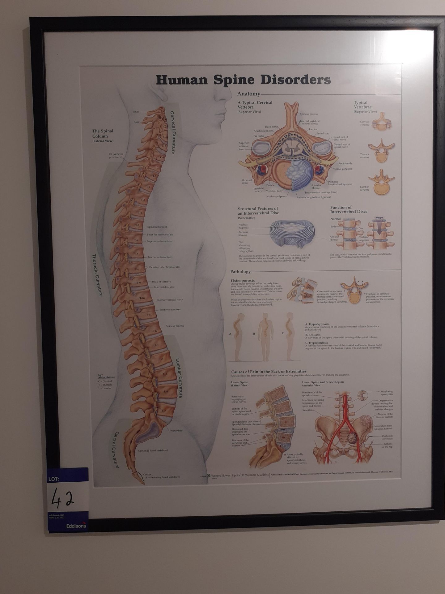 4 Framed Medical Prints - Image 2 of 4