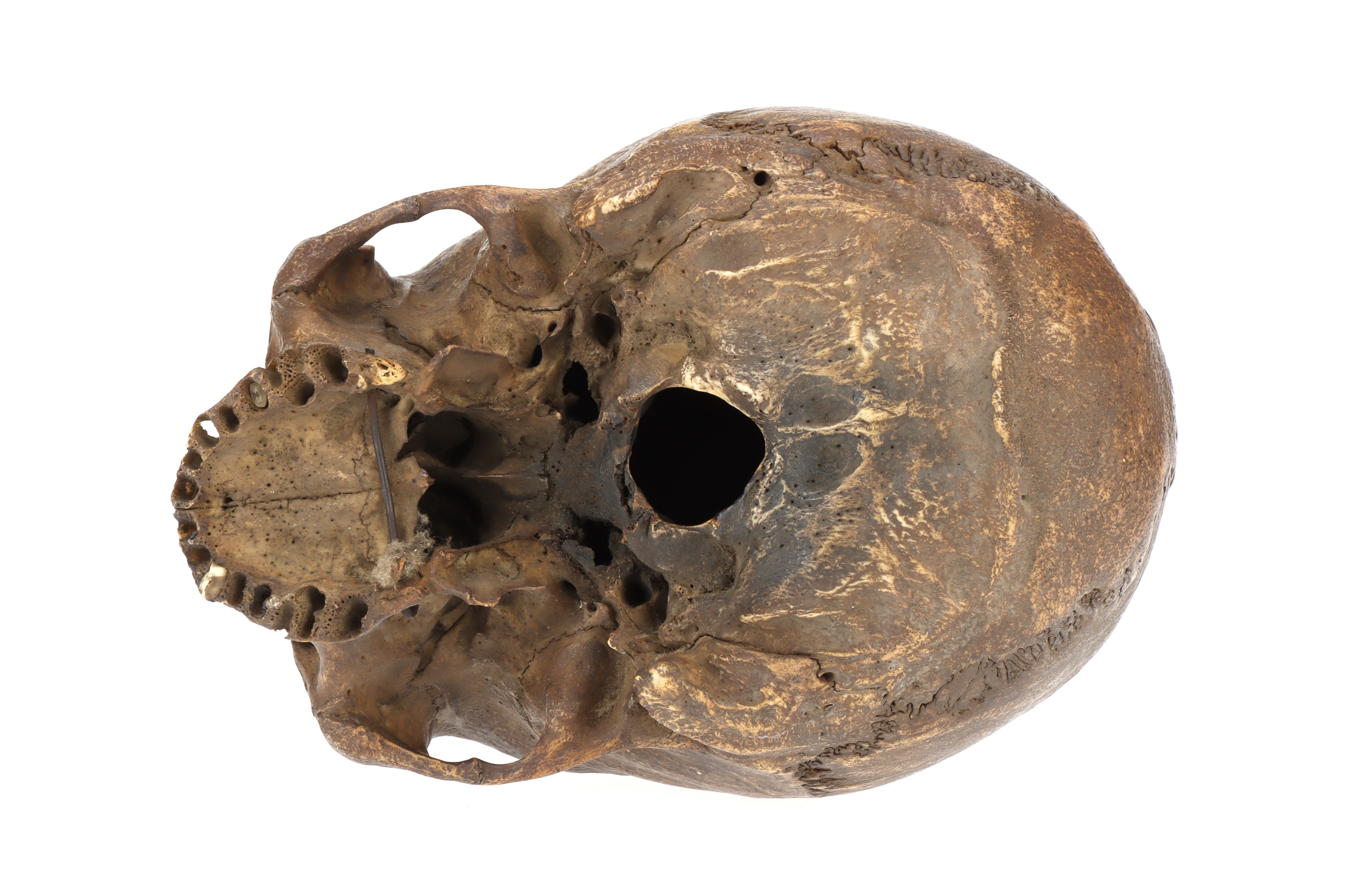 An Ancient Human Skull, - Image 3 of 4