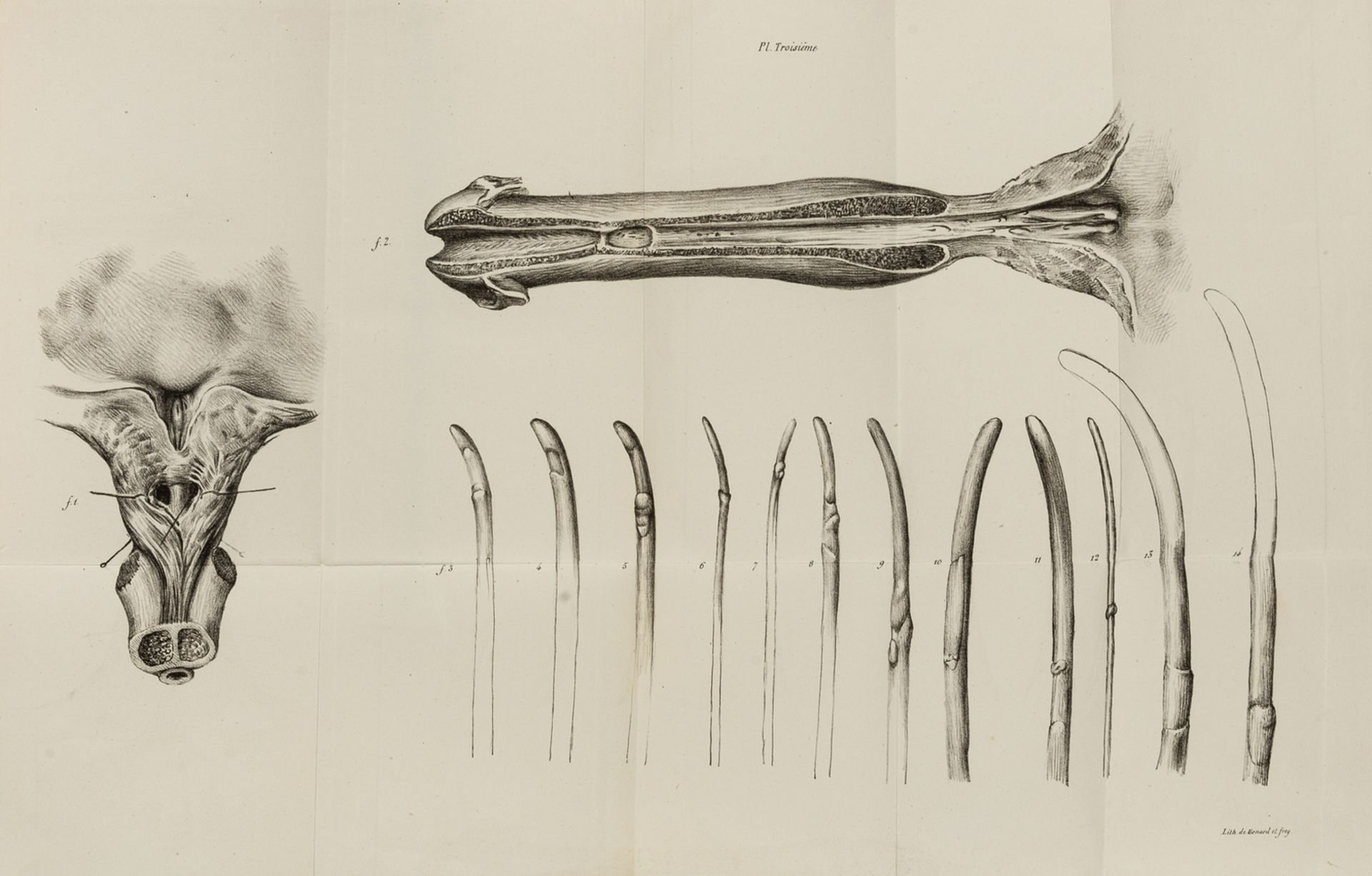 Abdominal Organs.- Pott (Percivall) Remarks on the Disease, commonly called a Fistula in Ano, …