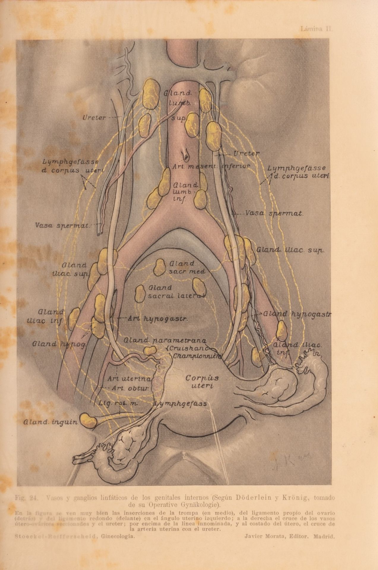 TRATADO DE GINECOLOGÍA. Primera edición española. - Bild 5 aus 6