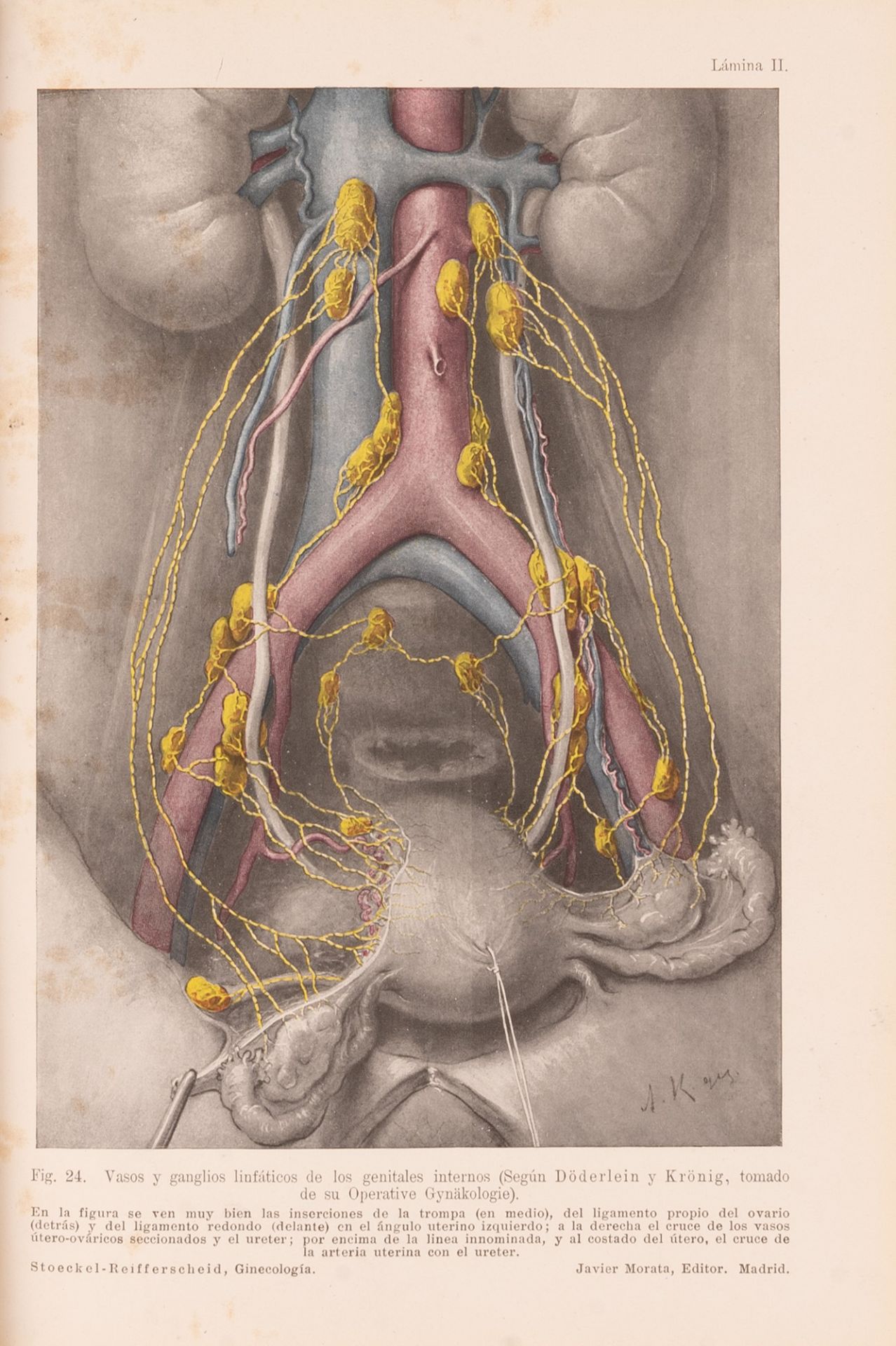 TRATADO DE GINECOLOGÍA. Primera edición española. - Bild 6 aus 6