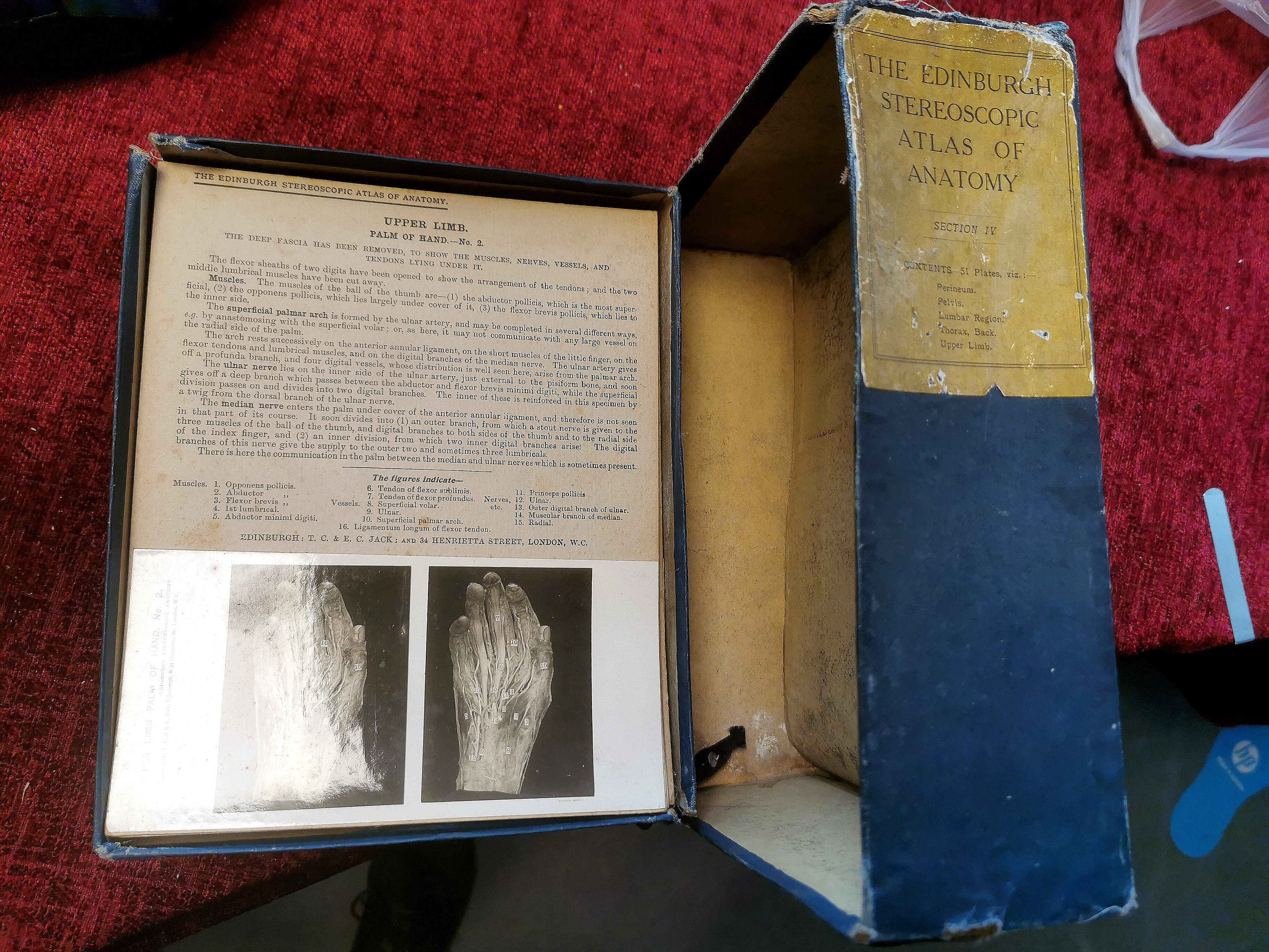 2x Edinburgh Stereoscopic Atlas of Anatomy Folders - Vol 2 and 4 - Image 3 of 3