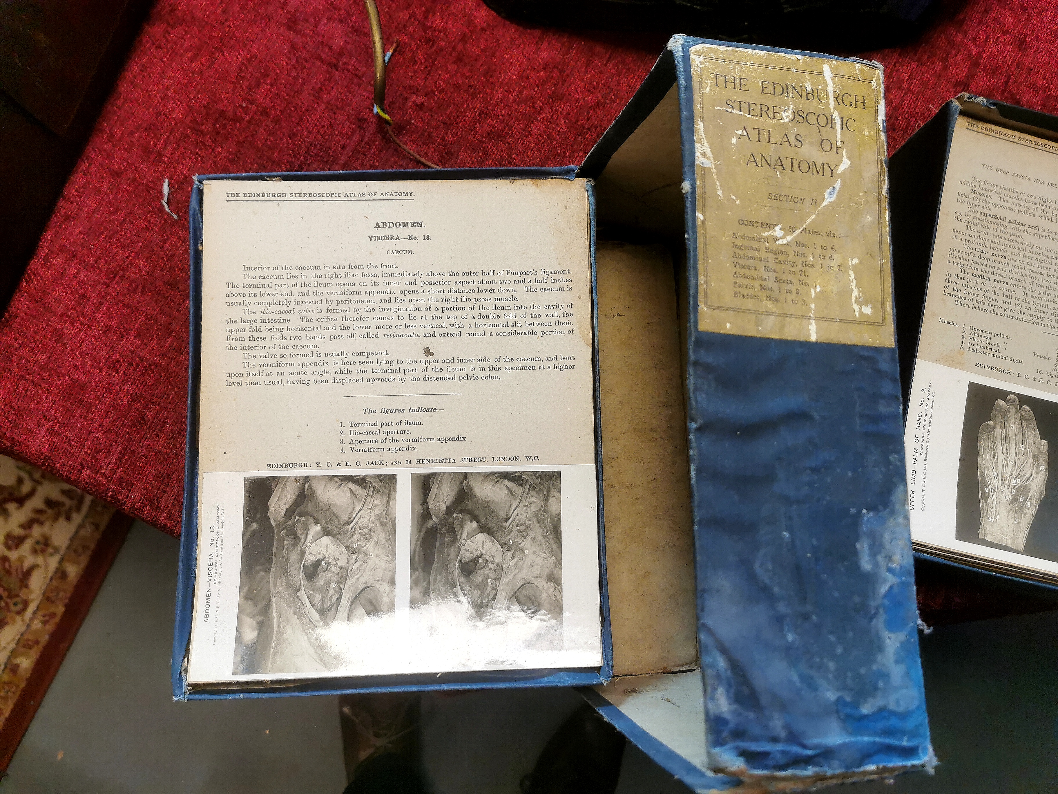 2x Edinburgh Stereoscopic Atlas of Anatomy Folders - Vol 2 and 4 - Image 2 of 3