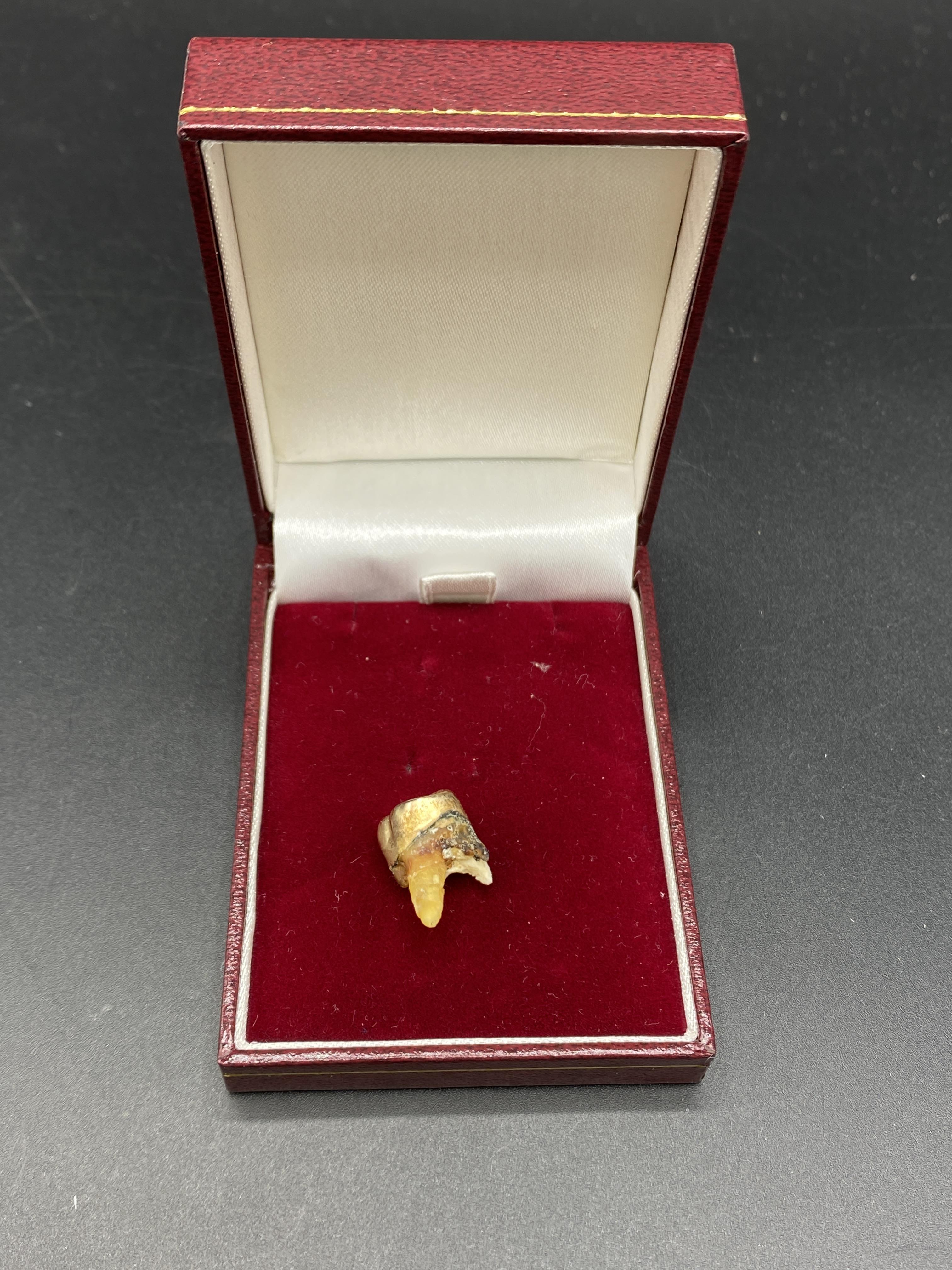Tooth with gold crown - Image 2 of 2