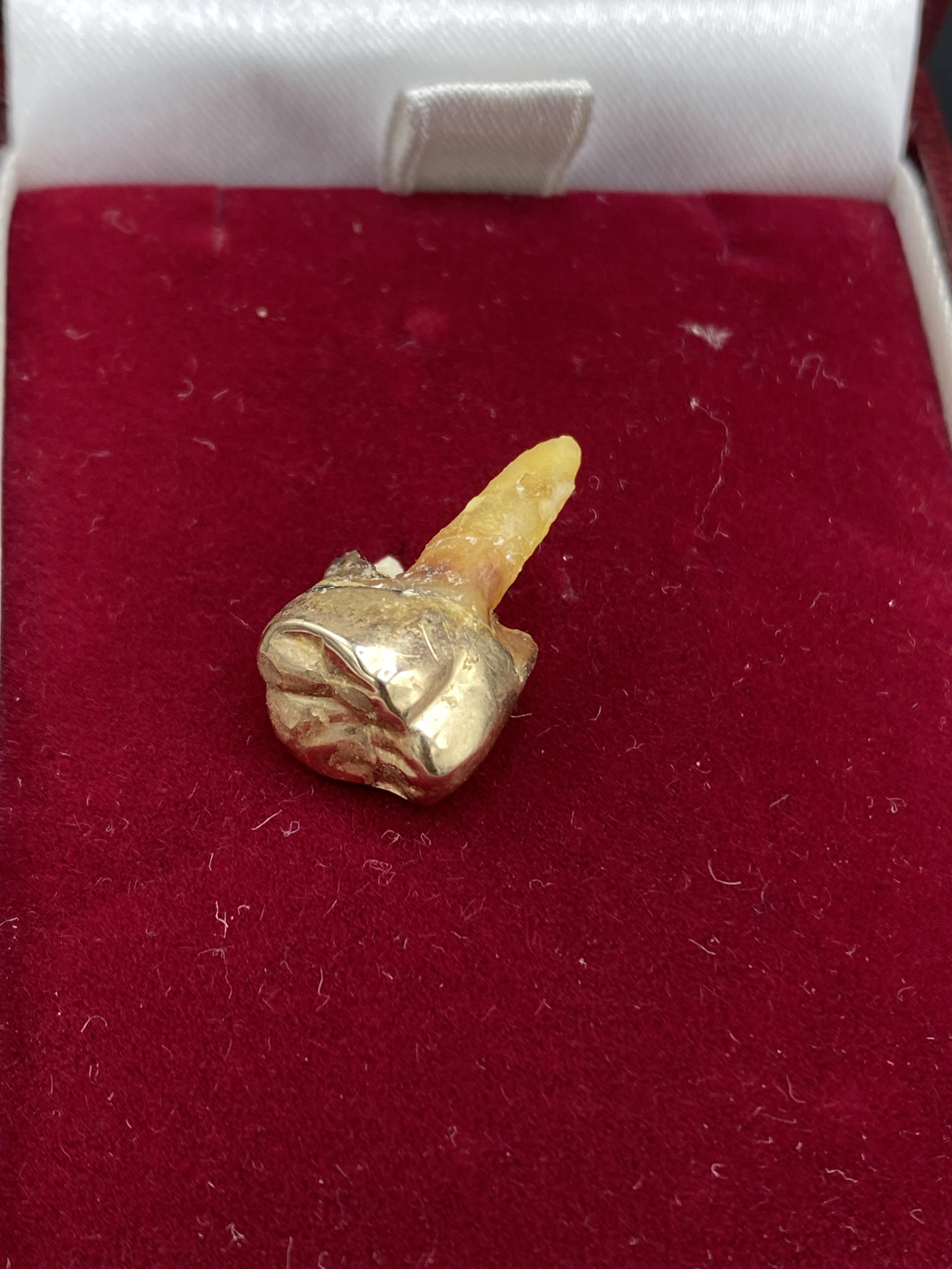 Tooth with gold crown