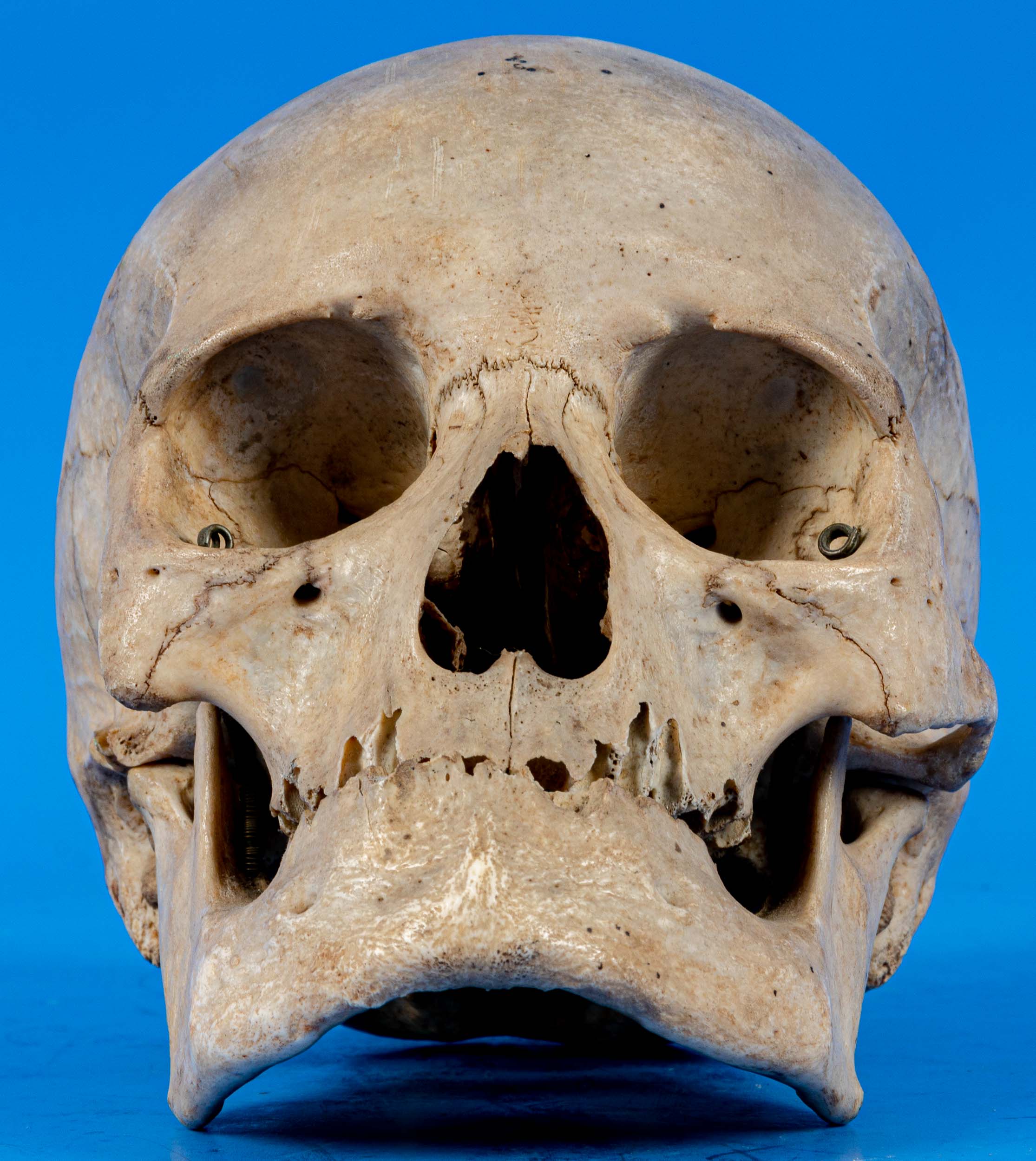 Antiker, zahnloser, menschlicher Schädel als anatomisches Anschauungsmodell, wohl um 1900, aus dem