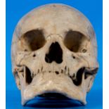 Antiker, zahnloser, menschlicher Schädel als anatomisches Anschauungsmodell, wohl um 1900, aus dem