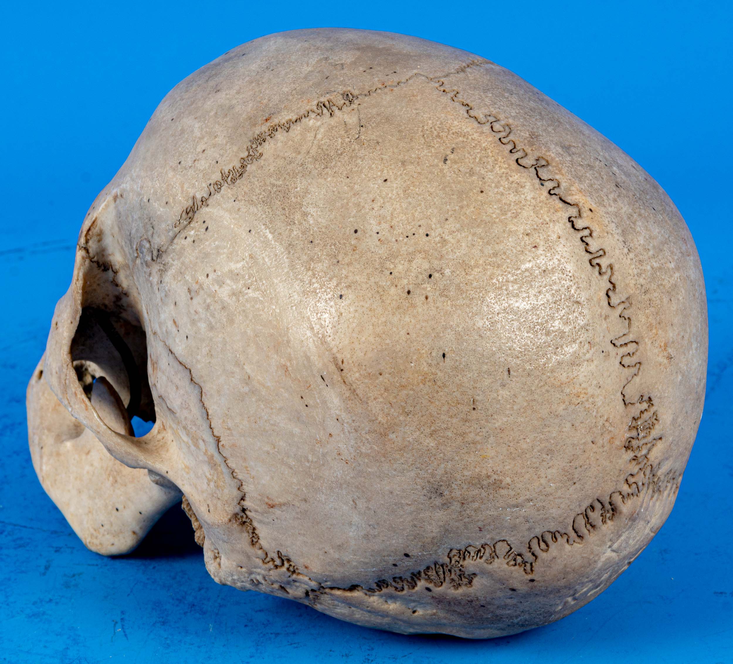 Antiker, zahnloser, menschlicher Schädel als anatomisches Anschauungsmodell, wohl um 1900, aus dem - Image 6 of 7