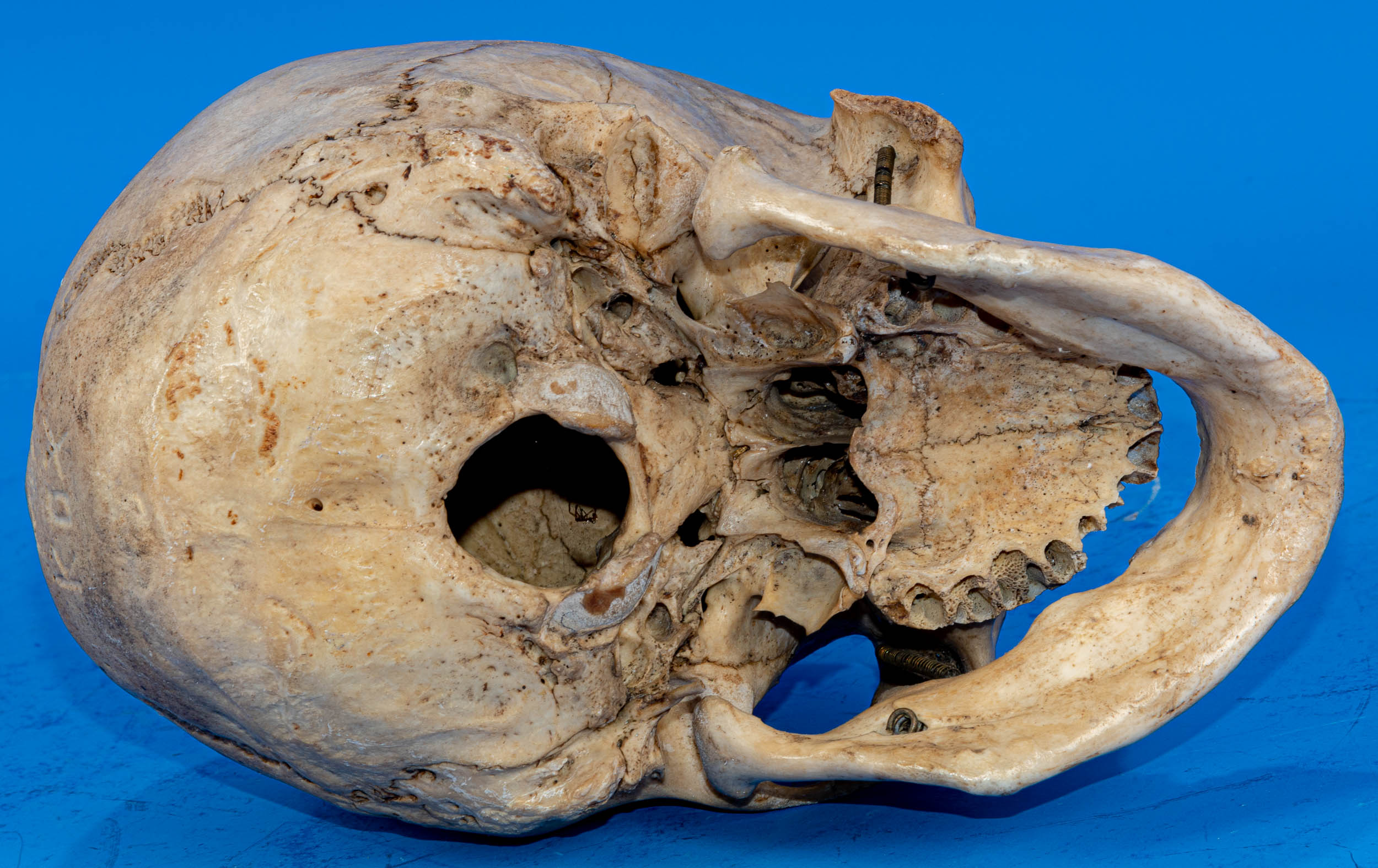 Antiker, zahnloser, menschlicher Schädel als anatomisches Anschauungsmodell, wohl um 1900, aus dem - Image 7 of 7