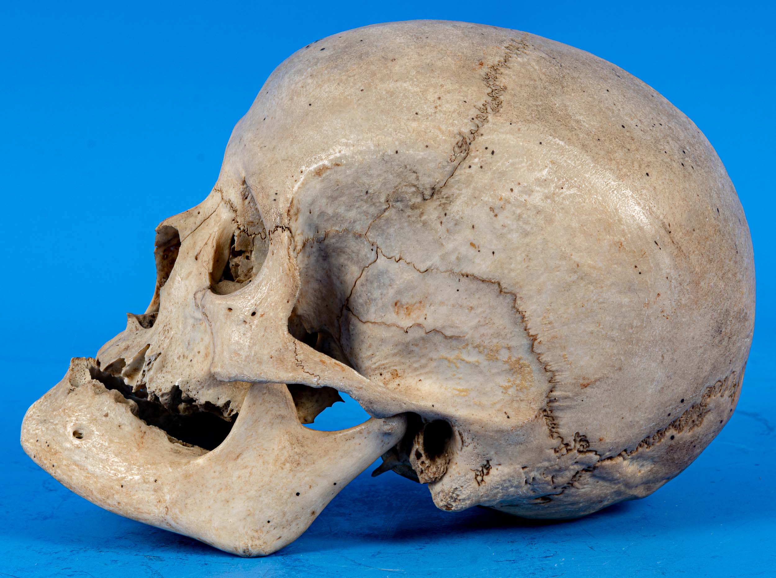 Antiker, zahnloser, menschlicher Schädel als anatomisches Anschauungsmodell, wohl um 1900, aus dem - Image 5 of 7
