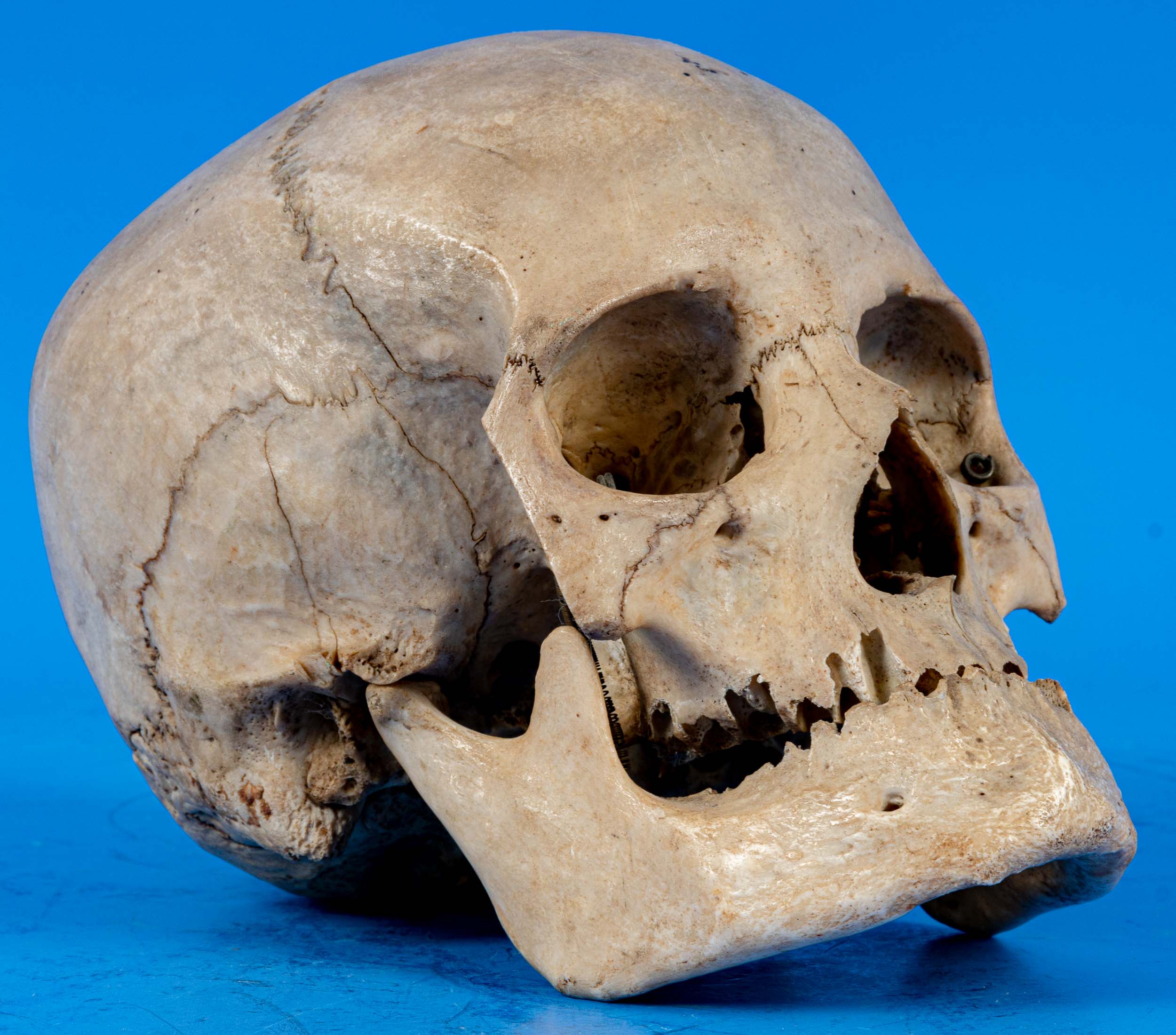 Antiker, zahnloser, menschlicher Schädel als anatomisches Anschauungsmodell, wohl um 1900, aus dem - Image 2 of 7