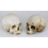 Zwei echte menschliche Schädel, 19. Jh. oder älter, Unterkiefer fehlen, Zähne im Oberkiefer teils