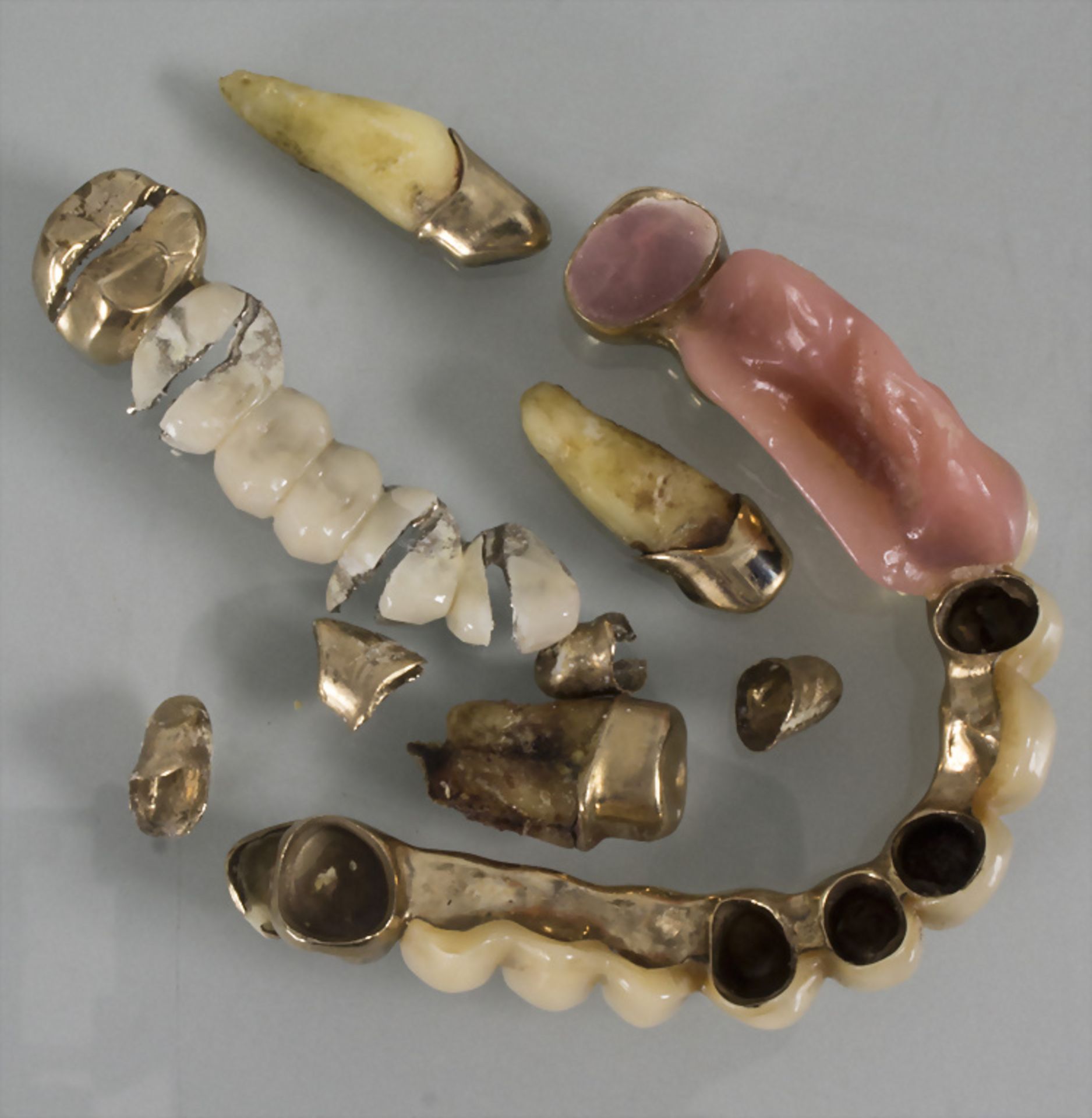 Konvolut Zahngold / A set of dental gold