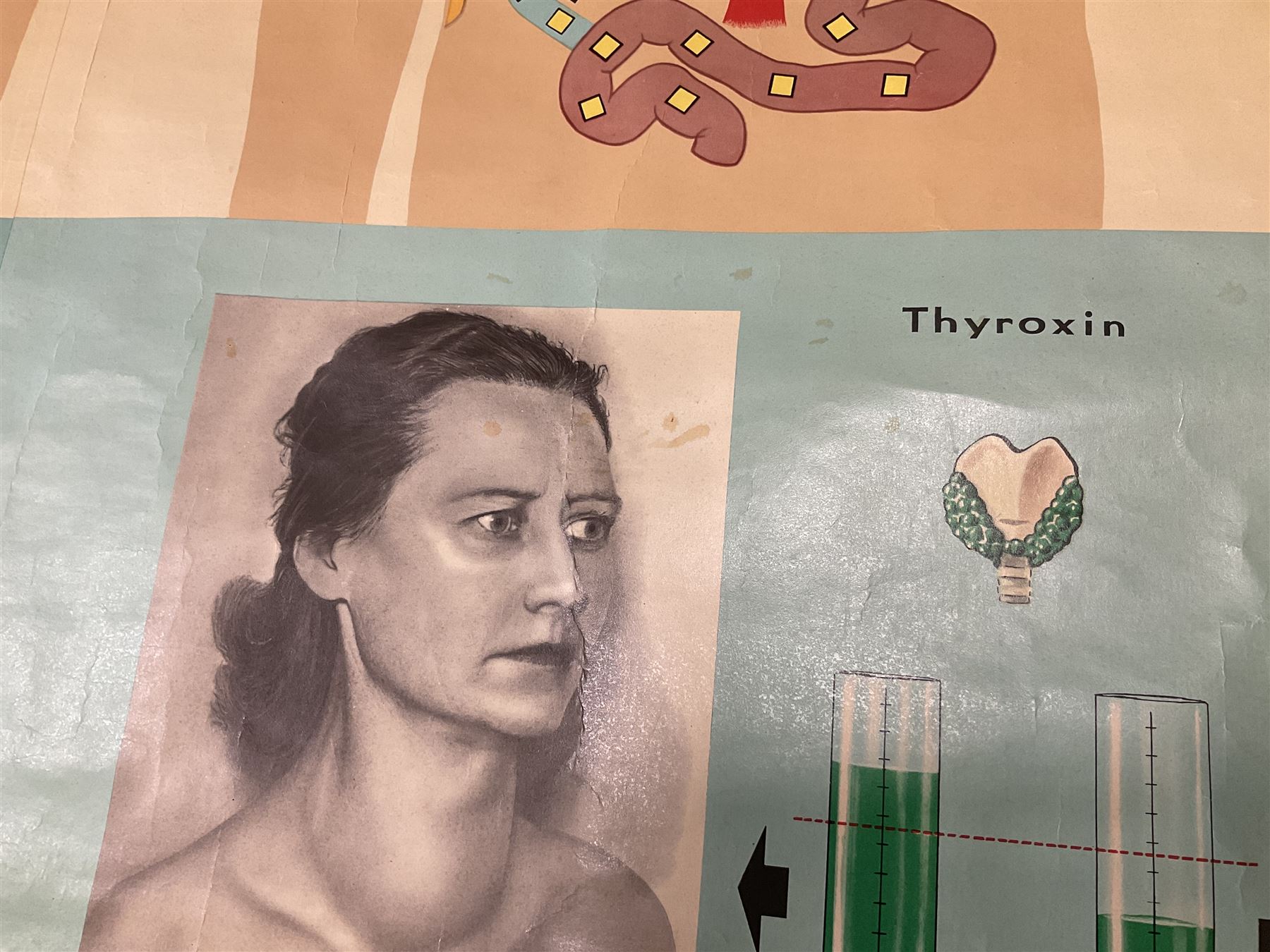 Large 1960s German educational school poster illustrating the endocrine (hormone) system - Image 3 of 8