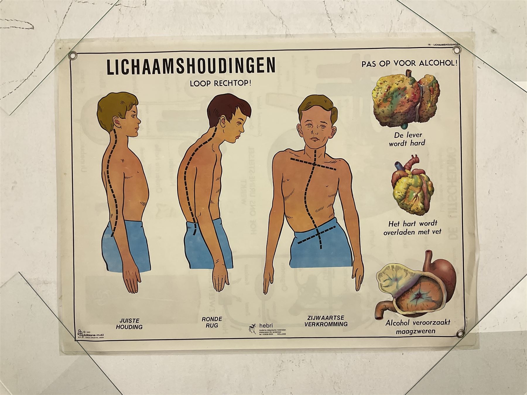 Three early 1980s Dutch medical posters - Image 7 of 7