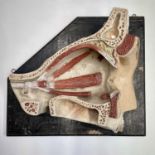 A Russian anatomical plaster model of an eye socket, mid 20th century, on ebonised backboard,