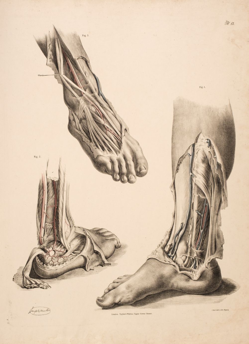 * Maclise (Joseph). Fifty medical and surgical lithographs, circa 1856