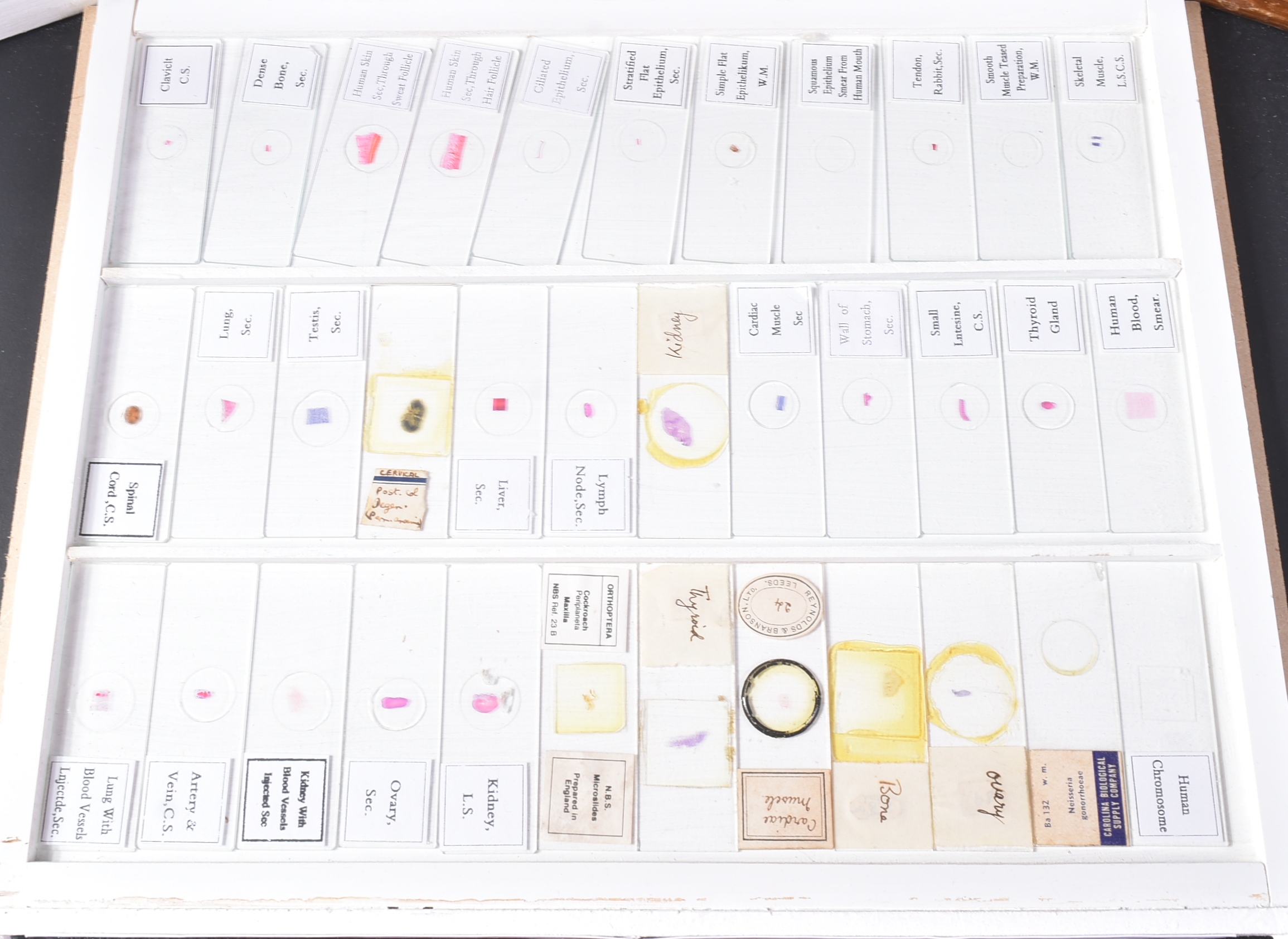 LARGE & EXTENSIVE BECK CABINET MICROSCOPE SLIDE COLLECTION - Image 71 of 101