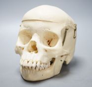 A human skull, acquired c.1976.14 cms high x 19.5 wide.