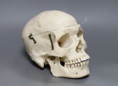 A human skull,21 cms wide,