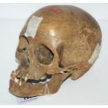 A partial human skeleton including skull, foot bones, odd ribs, sacrum, arm and legs bones etc, A