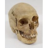 HUMAN BONES Comprising skull with detached cranium, circularly strung vertebrae, strung hand and