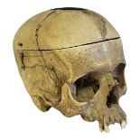 A 19TH CENTURY MEDICAL HUMAN SKULL Having a detachable lid and brass clasps. (approx 21cm x 18cm)