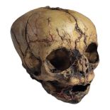 A LATE 19TH/EARLY 20TH CENTURY MEDICAL FETAL SKULL With coloured anatomical vein structure.