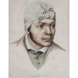 Syphilide PustuleusePortrait of a man with pustular syphilis, coloured print, engraved by Manceau,