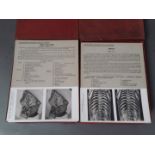 The Edinburgh Stereoscopic Atlas of Anatomy, sections III & IV, approx. 104 cards depicting