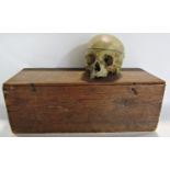 An early 20th century boxed partial human skeleton including a skull with hinged cranium