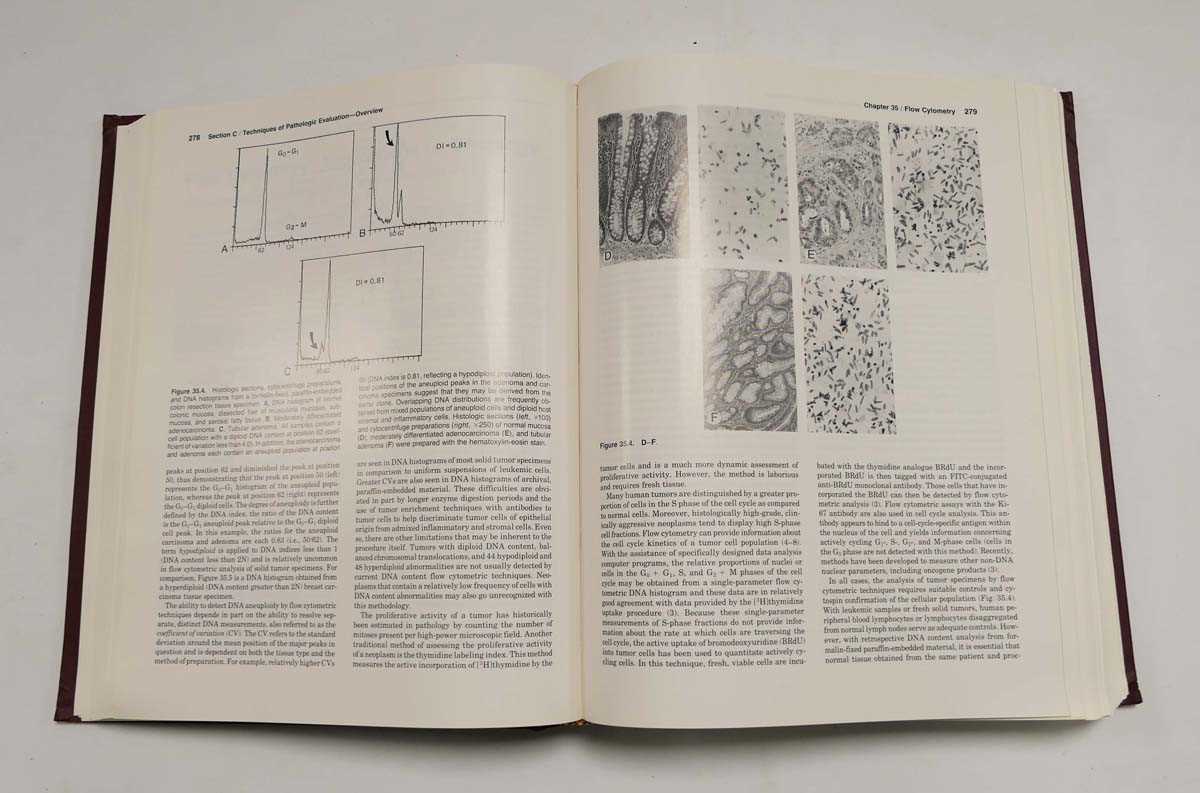 Moossa A., Schimpff S. & Robson M. ( Editors ) : Comprehensive Textbook of Oncology, 1991. 2nd. - Bild 3 aus 8