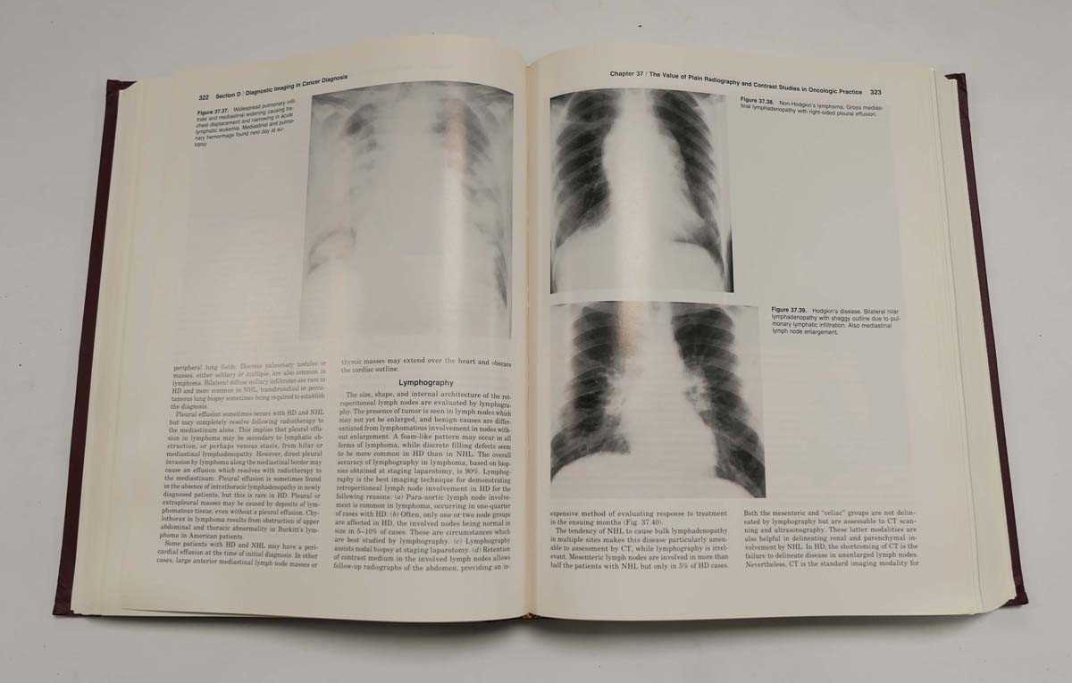 Moossa A., Schimpff S. & Robson M. ( Editors ) : Comprehensive Textbook of Oncology, 1991. 2nd. - Bild 4 aus 8